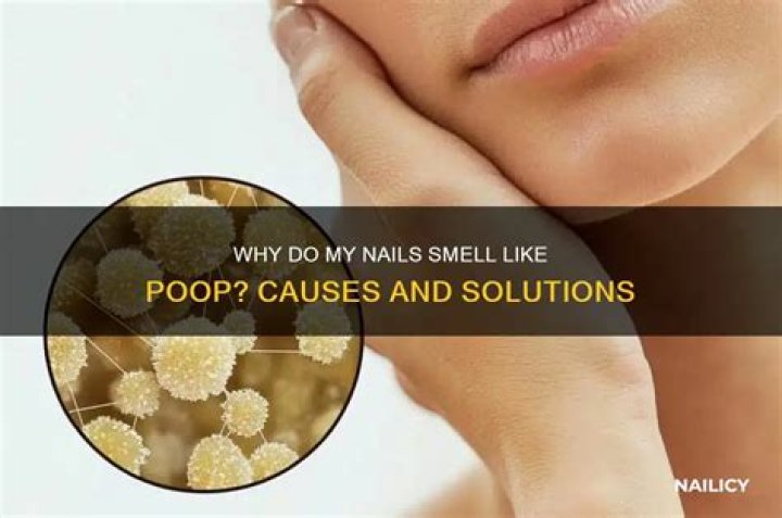 Furry Nails Smell Like Poop: Causes, Solutions, and Expert Care Tips